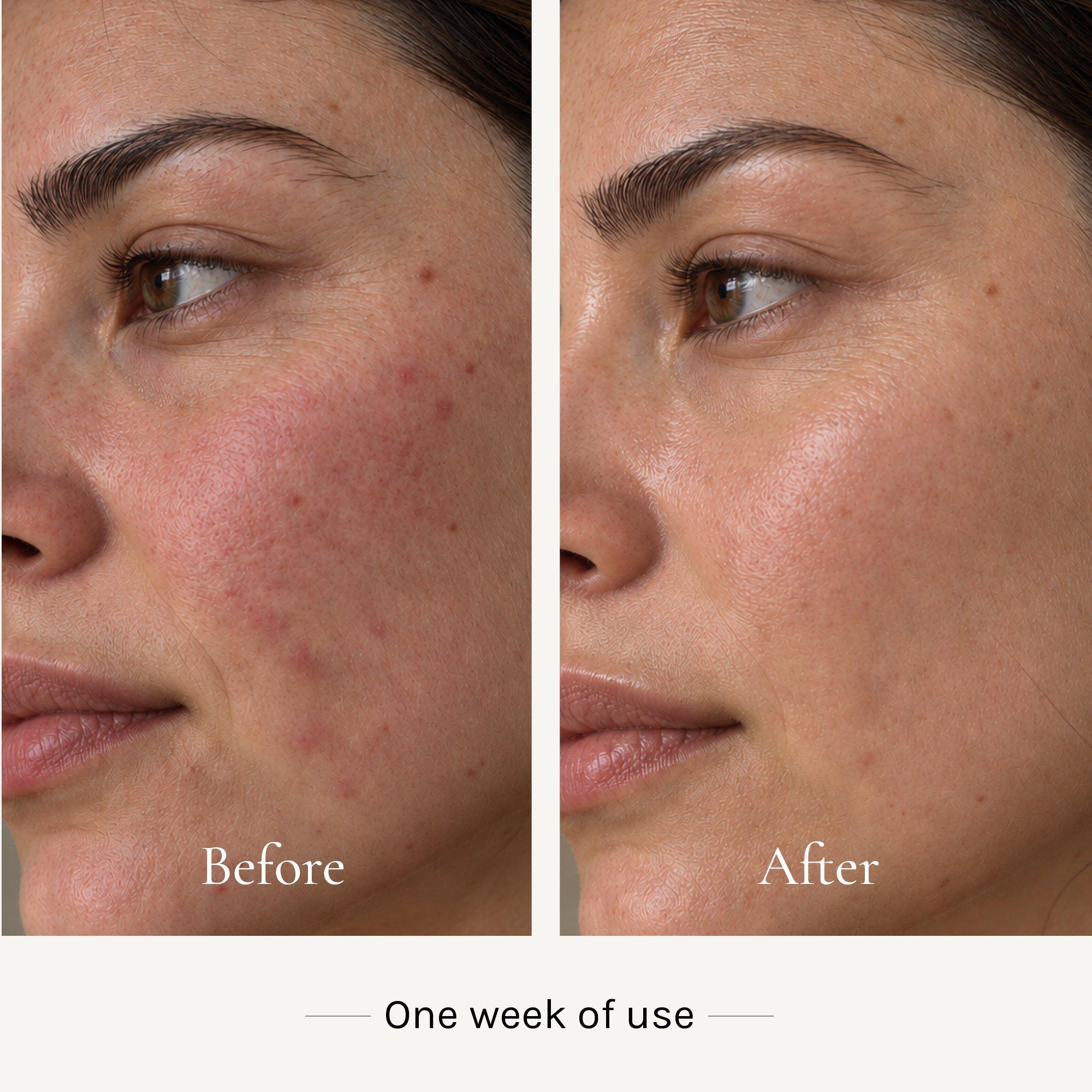 KI'OLAL BIOCOSMETICS Nourishing Cleanser — фото 5