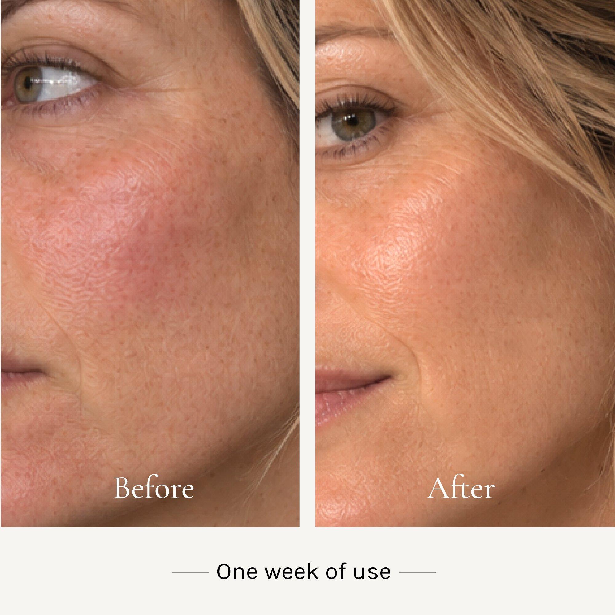 KI'OLAL BIOCOSMETICS Energizing Day Serum — фото 6