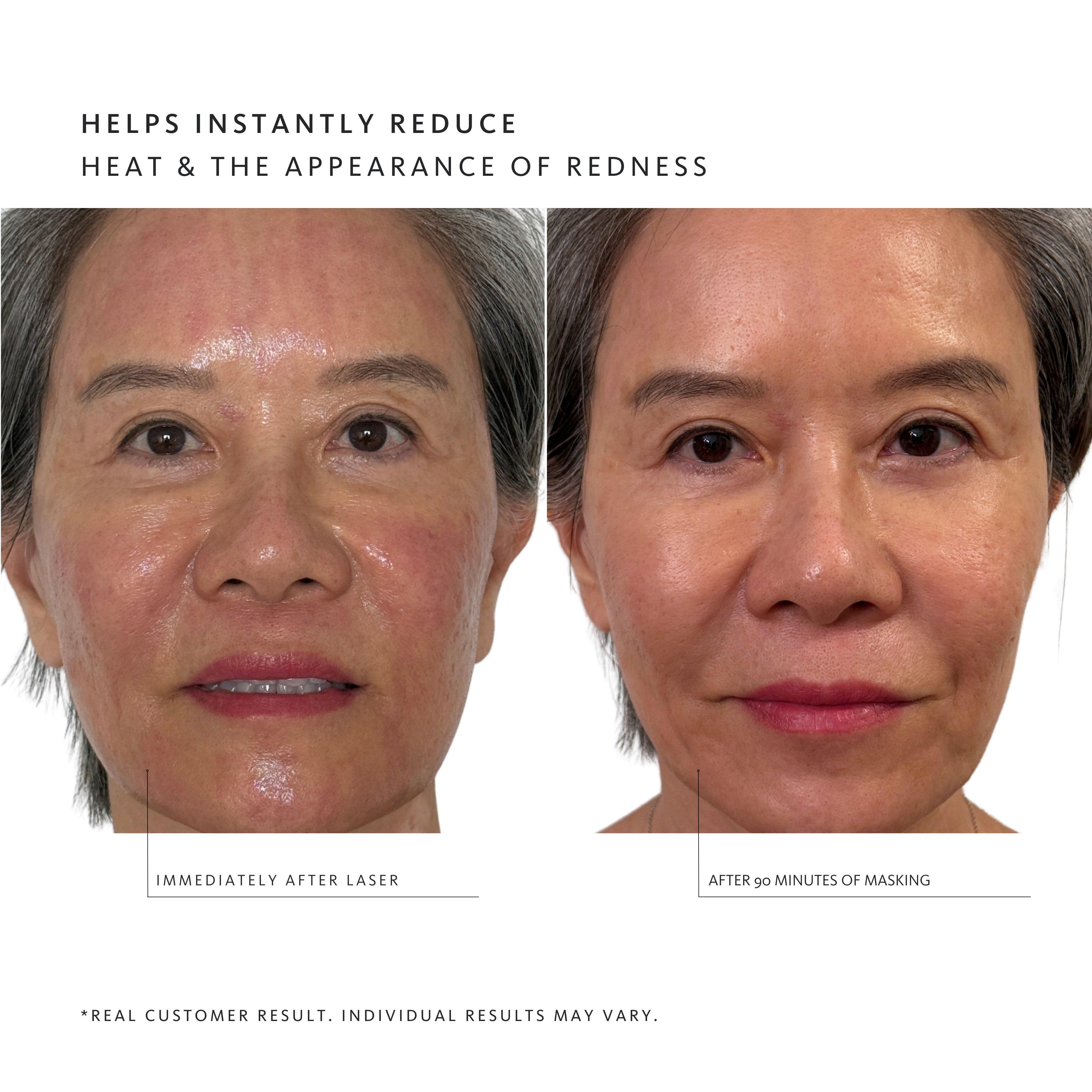 La Luer Thermoactivated Serum Gel Masks — фото 3