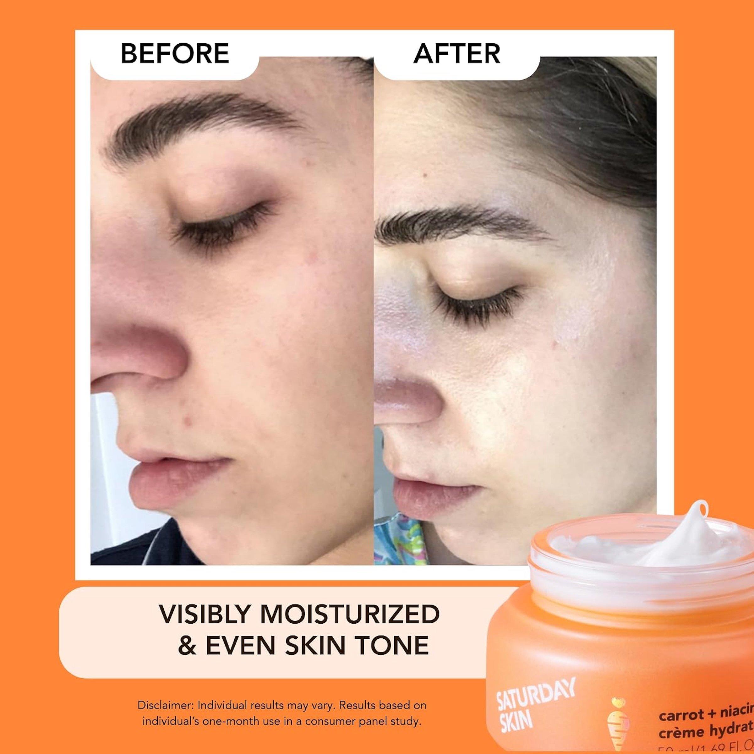 Saturday Skin Carrot + Niacinamide Hydrating Moisture Cream — фото 5