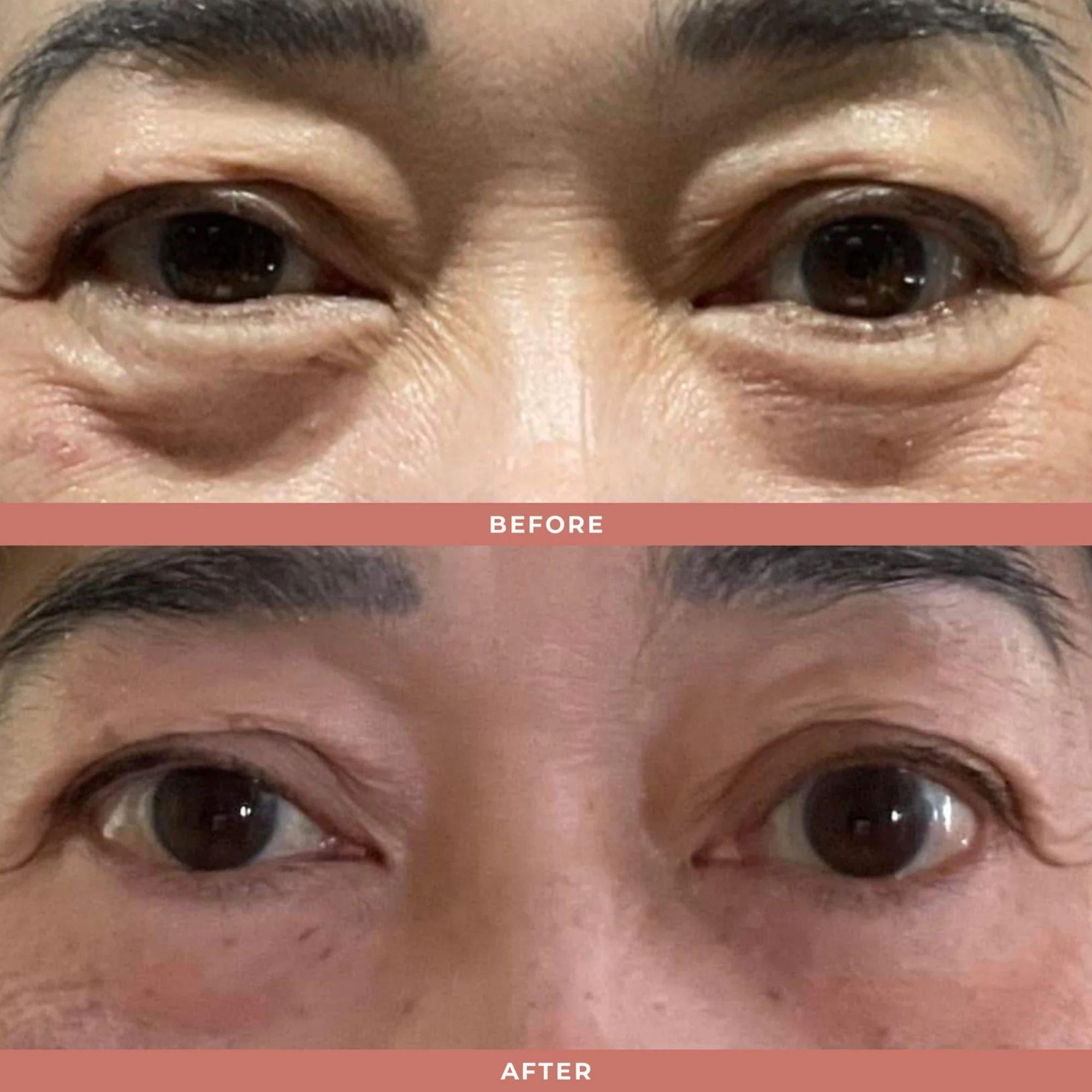Olivia Quido Skincare Wrinkle Blur Eye Brightener — фото 3