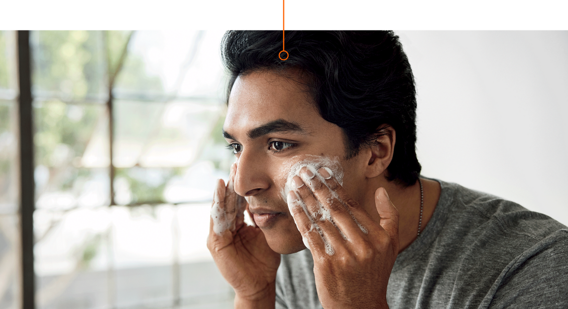 A Dermatologist Answers Top Acne Questions Ulta Beauty