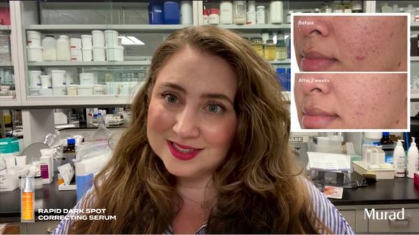 Murad Rapid Dark Spot Correcting Serum #11