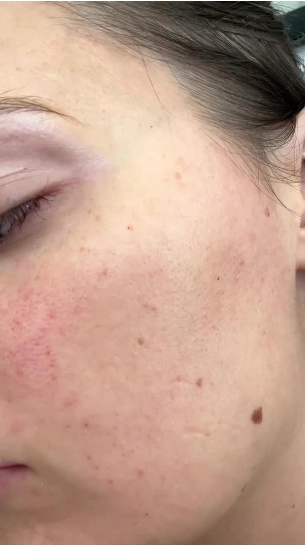 DIME Dark Spot Corrector Serum #9