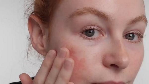 INKEY SuperSolutions 10% Azelaic Acid Serum Redness Relief Solution #6