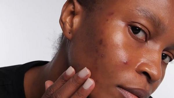 INKEY SuperSolutions 20% Niacinamide Serum #6