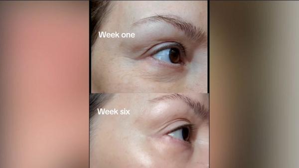 Murad Lift & ReSculpt with Retinal Trial Kit #9