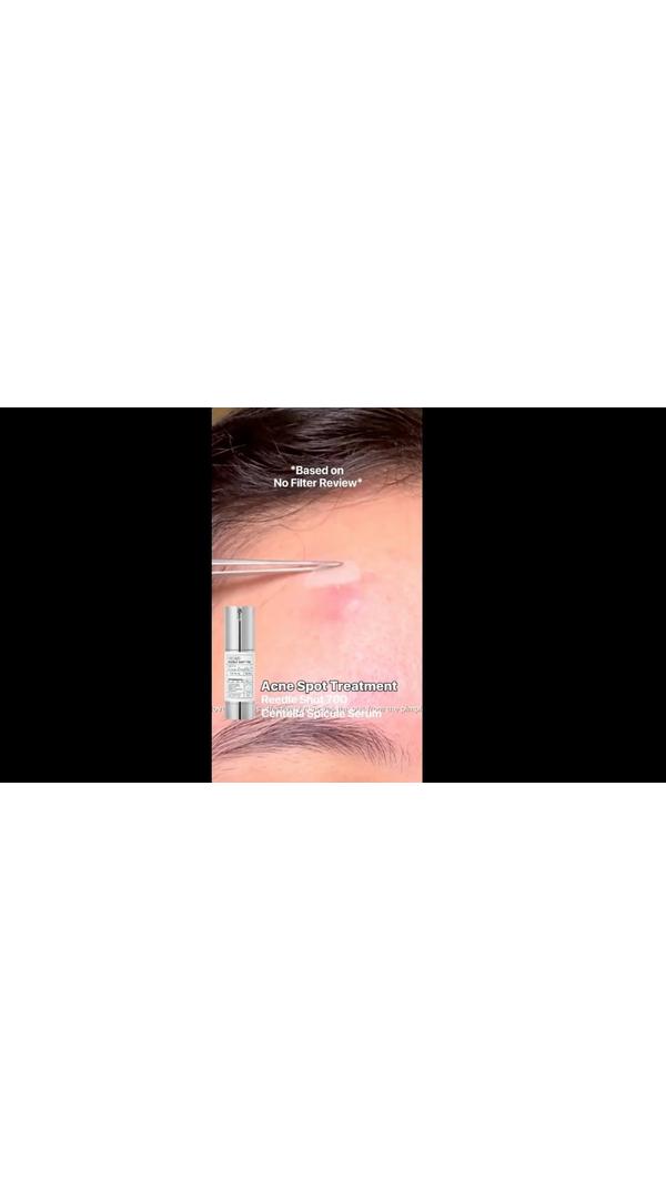 VT Cosmetics Reedle Shot 700 #6