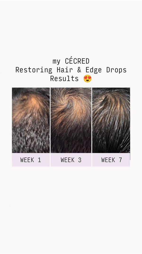 CÉCRED Restoring Hair & Edge Drops XL #9