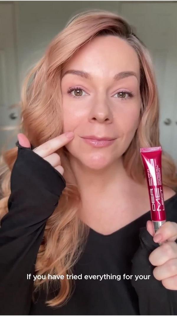 Dermelect Smooth Upper Lip Professional Perioral Anti-Aging Treatment #10